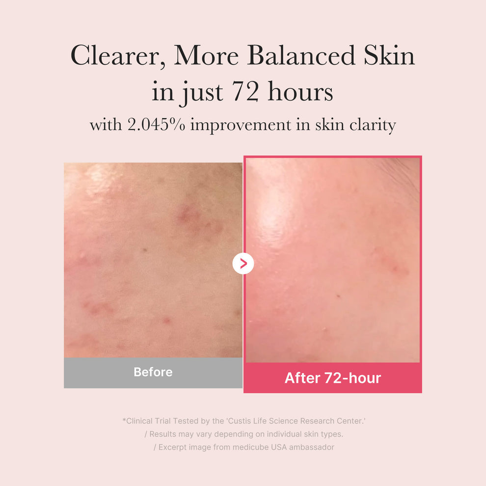 Medicube TXA Niacinamide Serum (30ml)