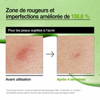 Before and after comparison of skin redness and imperfections with text on a green background