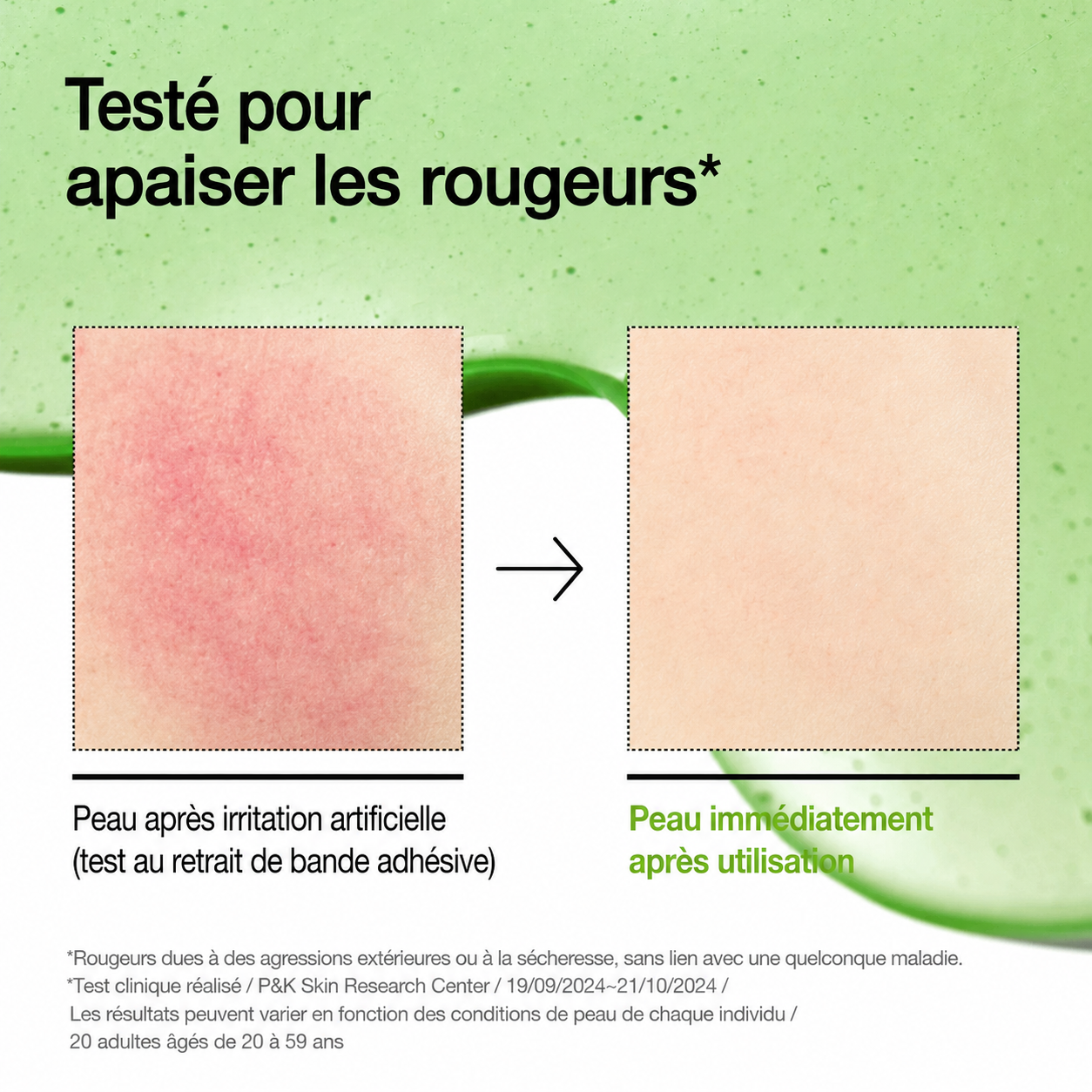 Before and after comparison of irritated skin with adhesive strip removal test on a green background.