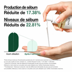 Anua Heartleaf Pore Control Cleansing Oil