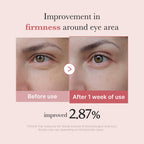 Medicube – PDRN Pink Peptide Eye Cream (30ml)