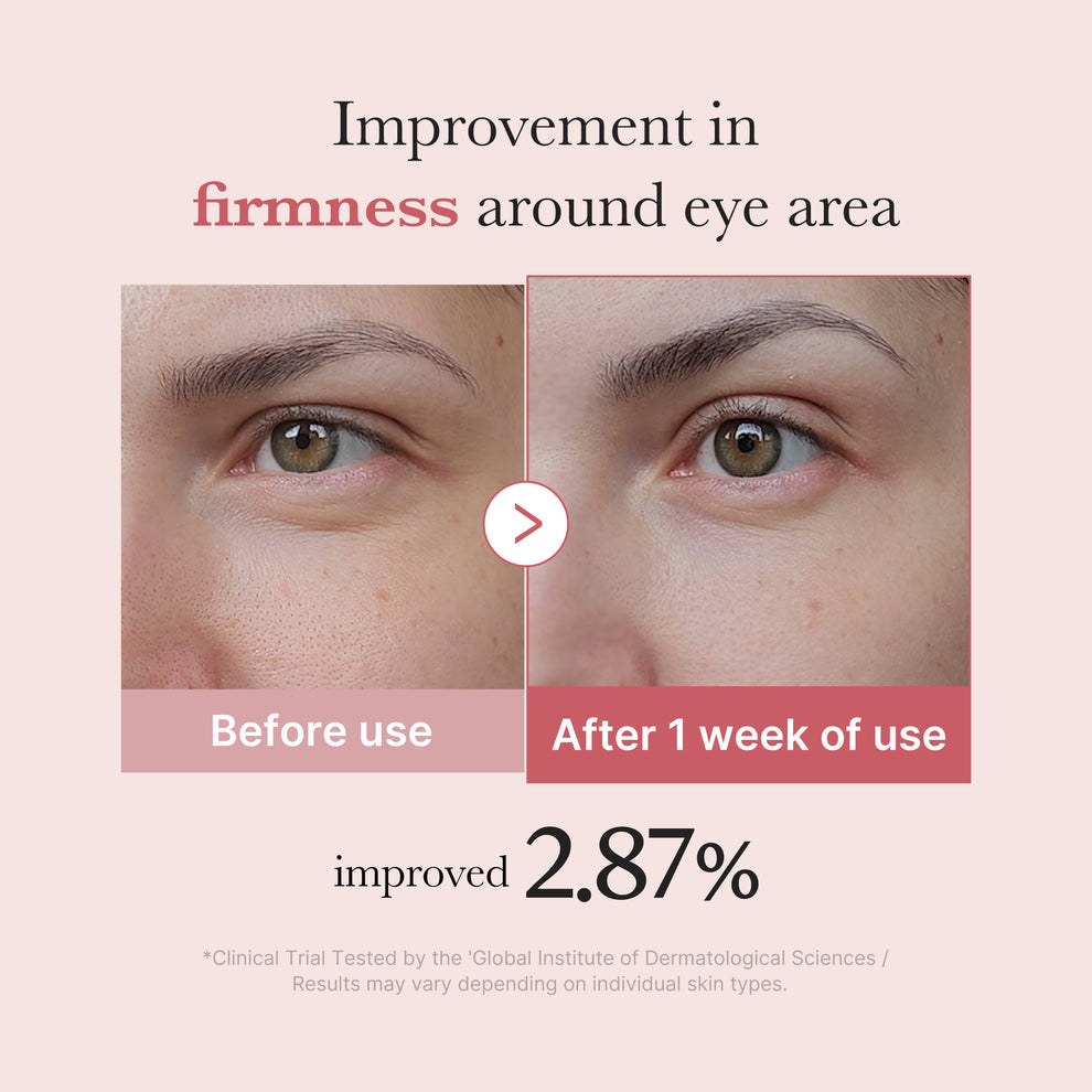 Medicube – PDRN Pink Peptide Eye Cream (30ml)