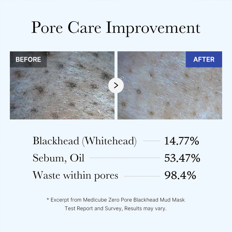 Medicube – Zero Pore Blackhead Mud Mask (100g)