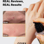 Cosrx skincare product with before and after skin comparison on a white background