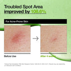 Anua Azelaic Acid 10 Hyaluron Redness Soothing Serum