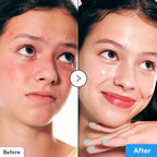 EQQUALBERRY Hyaltoin Flooding Serum (30ml)