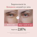 Medicube – PDRN Pink Peptide Eye Cream (30ml)