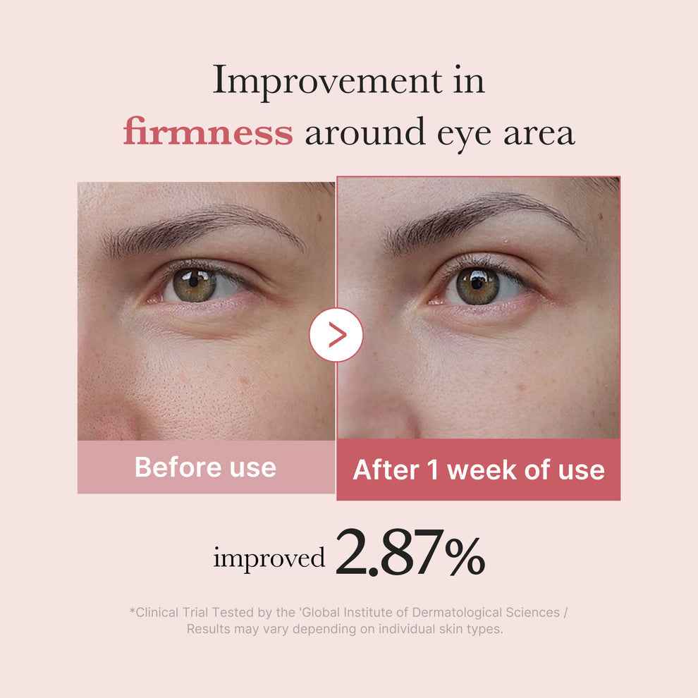 Medicube – PDRN Pink Peptide Eye Cream (30ml)